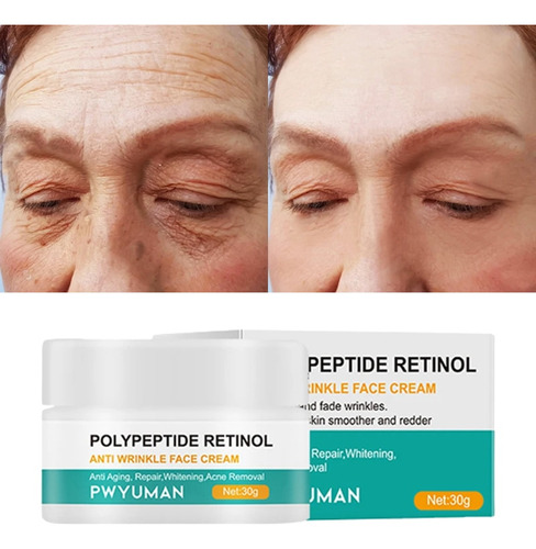 Crema Reafirmante Instantánea Removedora Facial Para Arrugas