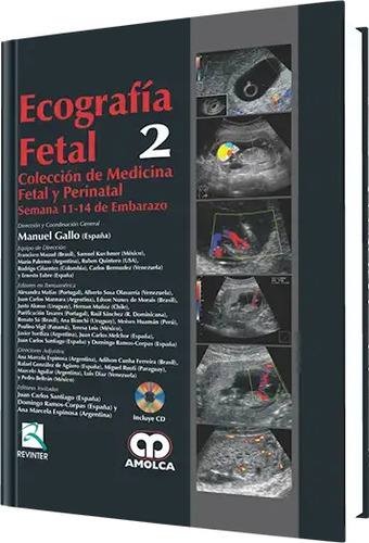 Ecografía Fetal Semana 11-14 De Embarazo. Volumen 2