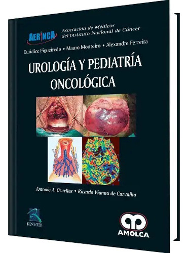 Urología Y Pediatría Oncológica