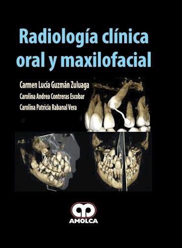 Radiología Clínica Oral Y Maxilofacial, De Guzmán Zuluaga, Carmen Lucia. Editorial Amolca En Español