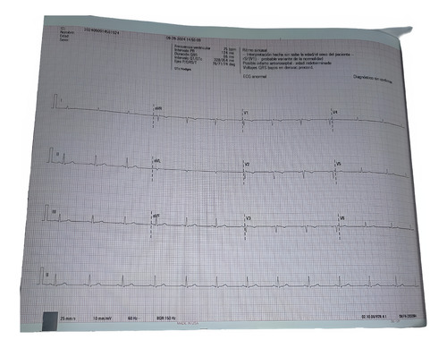 Cardiografo Mindray Beneheart R12
