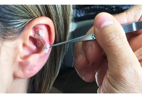 Ponto Auriculoterapia Cristal Auricular Micropore 350 Unid