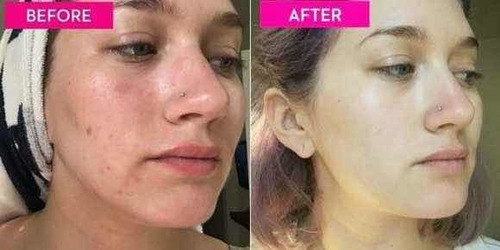 Tónico Facial I'm From Rice Toner, 150 Ml, Hidratante