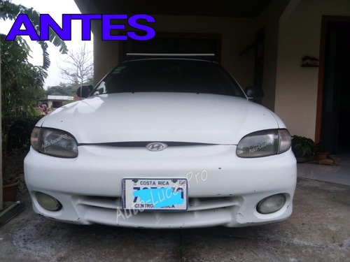 Imagen 6 de 8 de Modificaciones Para Focos Faros Huyndai Euro Acent 95-99