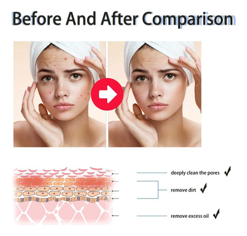 Exfoliante Líquido De Ácido Salicílico Con 2% De Bha Para El