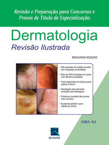 Dermatologia Revisão Ilustrada: Revisão e Preparação para Concursos e Provas de Título de Especialização, de Ali, Asra. Editora Thieme Revinter Publicações Ltda, capa dura em português, 2015