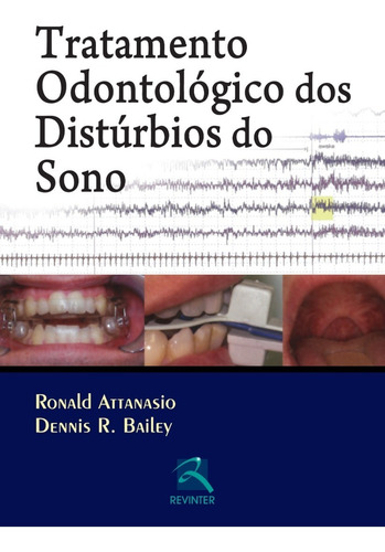 Livro: Tratamento Odontológico Dos Distúrbios Do Sono