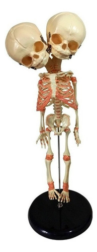 Modelo De Esqueleto De Bebé De Dos Cabezas