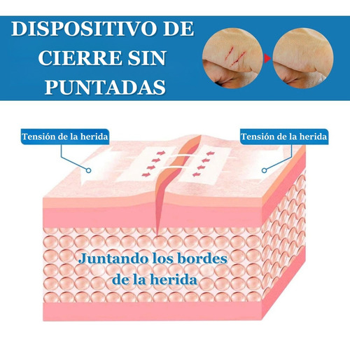 2 Tiras De Cierre Heridas De Emergencia Vendaje De Puntada