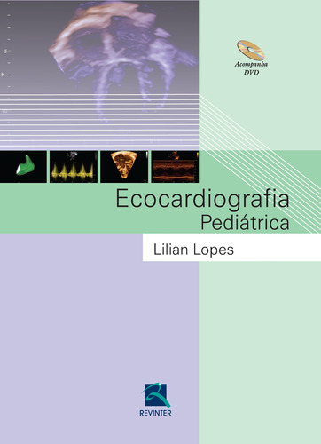 Ecocardiografia Pediátrica, de Lopes, Lilian. Editora Thieme Revinter Publicações Ltda, capa dura em português, 2015