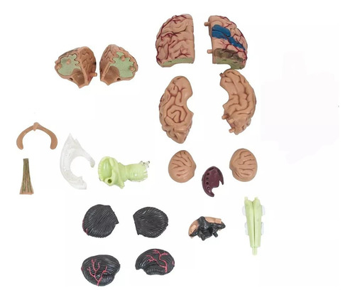 Modelo Anatómico Estudio Cerebro Humano Arterias Puzzle 4d