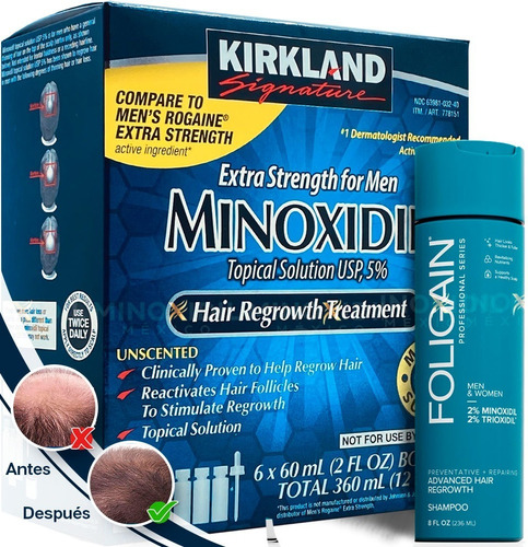 Imagen 1 de 5 de Minoxidil 5% + Shampoo C/ Minoxidil 2% & Trioxidil 236 Ml