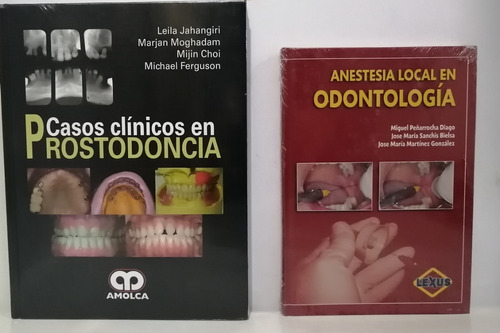 Anestesia Local En Odontología Y Prostodoncia Clínica