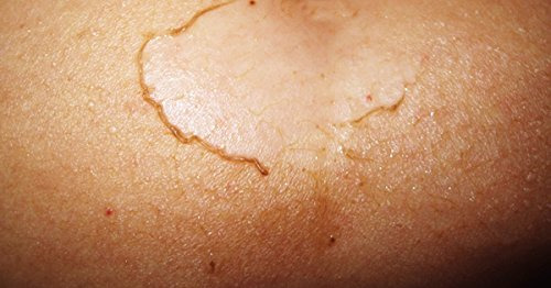 Sistema Exfoliante Baiden - Mejores Guantes Exfoliantes