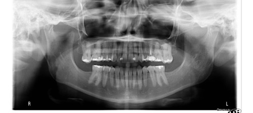 Panorámica Dental