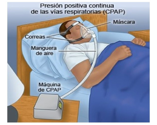 Reparación De Cpap / Apap