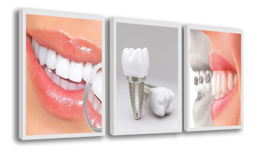 Quadro Decorativo Odontologia Consultório Dentista Moderno