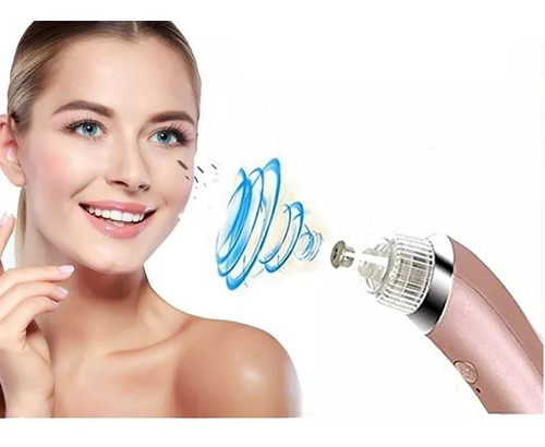 Removedor De Puntos Negros Exfoliacion Acne Limpieza Facial