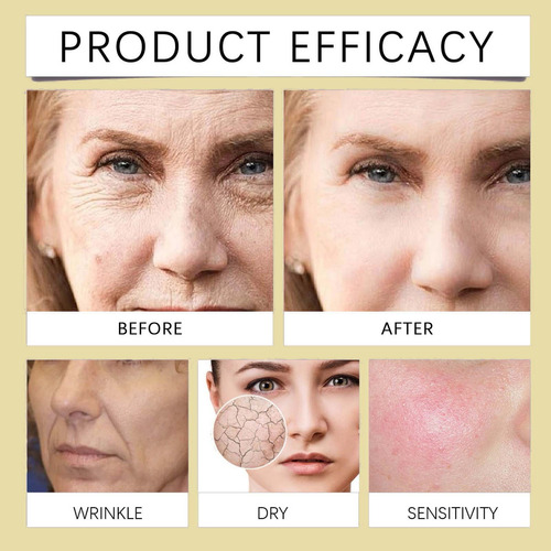 E Gold And Wrinkle Cream Arrugas Cream Arrugas Face Care 401