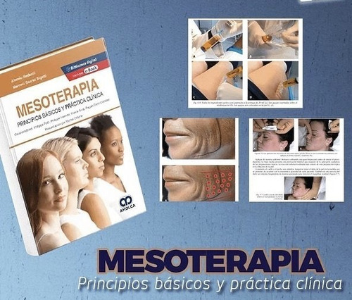 Mesoterapia Principios Básicos Y Práctica Clínica + E-book, De Alessio Redaelli., Vol. 1. Editorial Amolca, Tapa Dura En Español, 2022