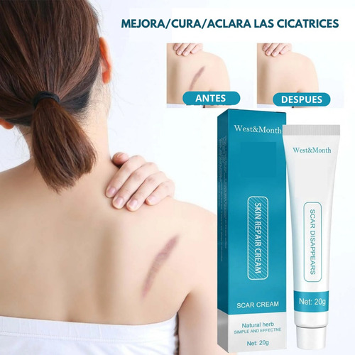 Crema Despigmentante De Manchas Para Cicatrices Paño Acne