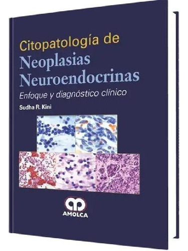 Libro - Citopatología De Neoplasias Neuroendocrinas