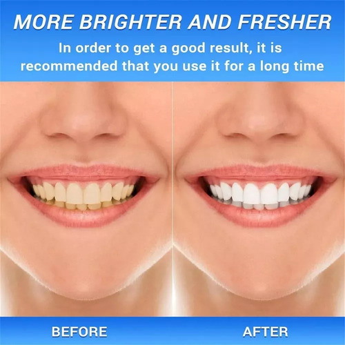Er Creme Dental, Crema Dental Branqueador