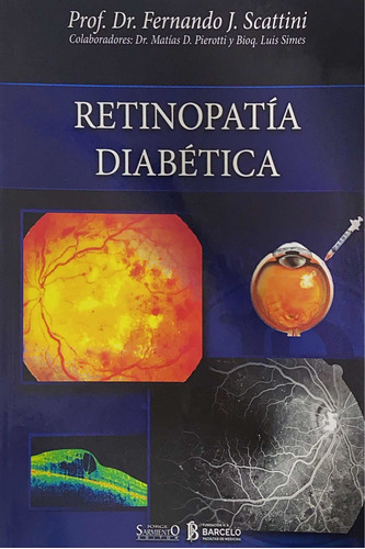 Scattini Retinopatía Diabética Nuevo Envíos T/país 