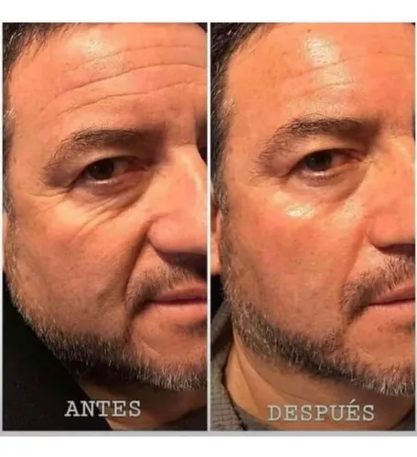 Colageno Hidrolizado Nuskin | Cuotas al mismo precio que publicaste
