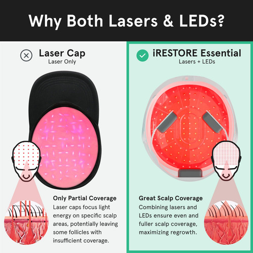 Sistema De Crescimento Capilar A Laser Irestore Essential Co