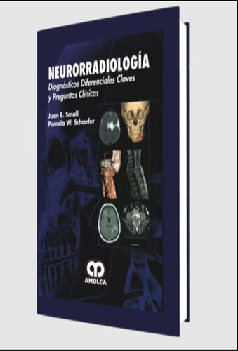 Neurorradiología. Diagnóstico Diferenciales, Claves Y Pregun