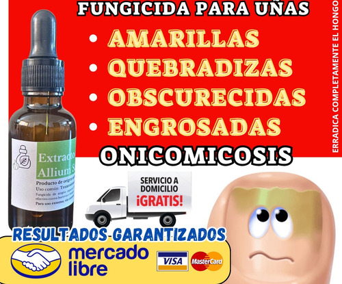 Uñax, Extracto Allium Sativum Onicomicosis (completo)