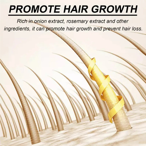 . Shampoo Para Crescimento Capilar 2025 Com Cebola E