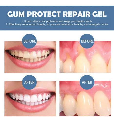 - 4×gel Reparador Dientes, Repara Las Encías Inflamadas