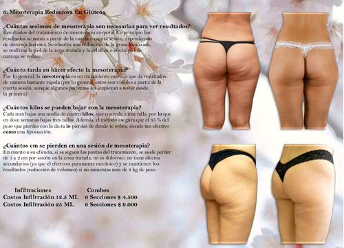 Celulitis En Gluteos Dile Adios Mesoterapia Reductora