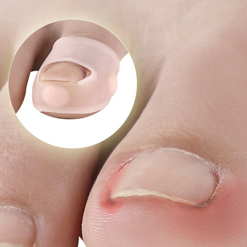 10 Pares De Fijador De Corrección De Uñas De Silicona Para