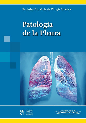 Patología De La Pleura Sect