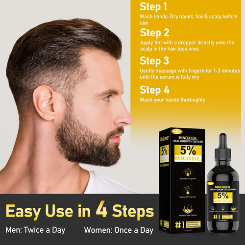 Tratamiento Anticaída Wulumer Minoxidil 5% Serum 60 Ml/2 Oz