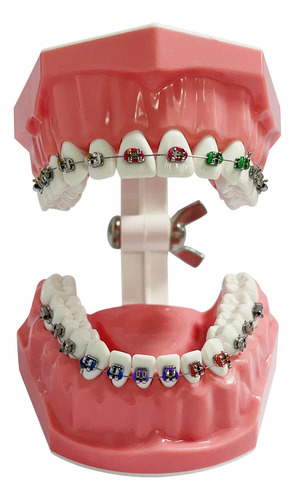 Modelo Dental Typodont Para Ortodoncia Educativa Con Frenill