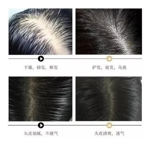 Shampoo Reparador Raíz Jengibre Anticaída Crecimiento.