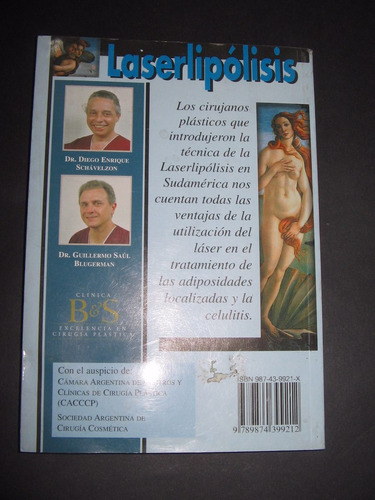Laserlipolisis Schavelzon & Blugerman Ed. Clave Azul $ 430