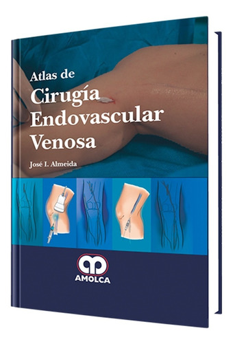 Atlas De Cirugía Endovascular Venosa.