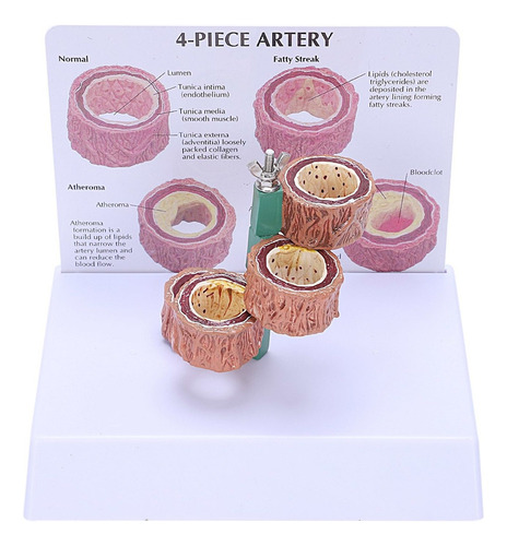 Demostración De Un Modelo De Trombosis Ateroesclerosis