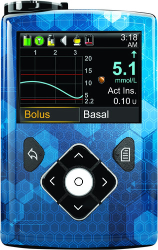 Stiker Para Personalizar Tu Bomba Medtronic 630g, 640g Y 670