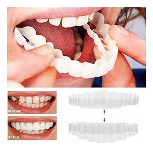 B 1 Par De Dentaduras Postizas Artificiales De Silicona