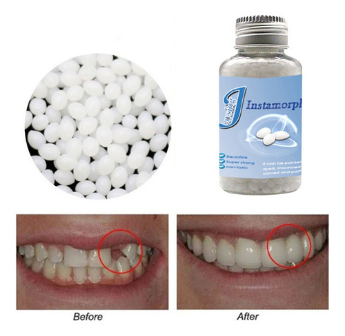 Cola Adesiva Dentes Espaços Dentes Postiços 30g