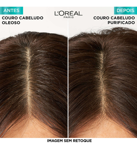 Shampoo Elseve Pure Hialurônico 200ml - Kit Com 2 Unidades