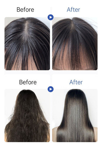 * ! Shampoo Para Remover Bronzeado E Caspa Com Dissulfeto D