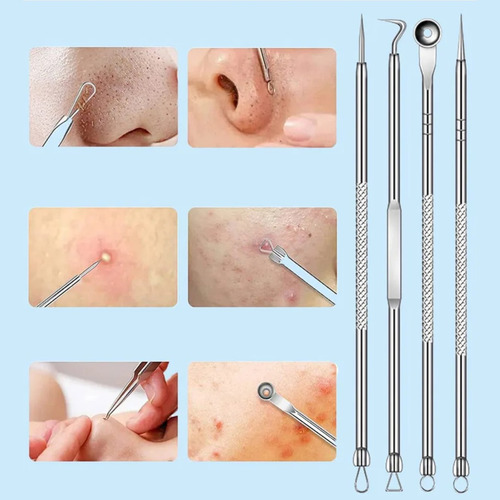Kit Removedor Extractor Puntos Negros Espinillas Acne 4 Pzs