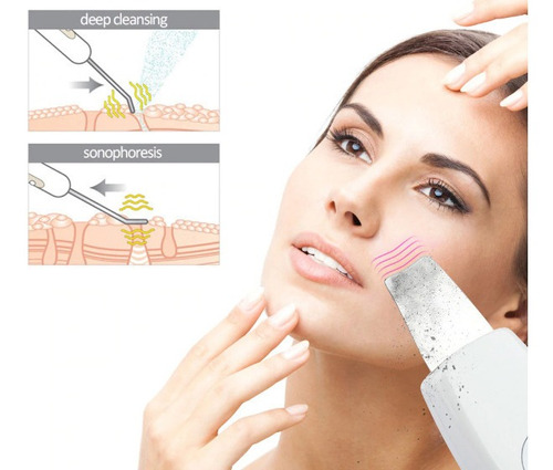 Depurador Exfoliador Limpiador Ultrasonico Facial Profunda P